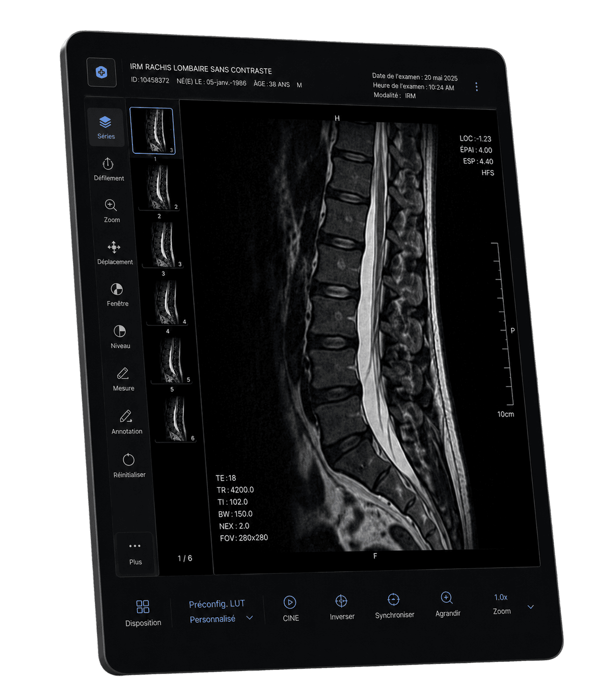 Visualiseur IRM DICOM