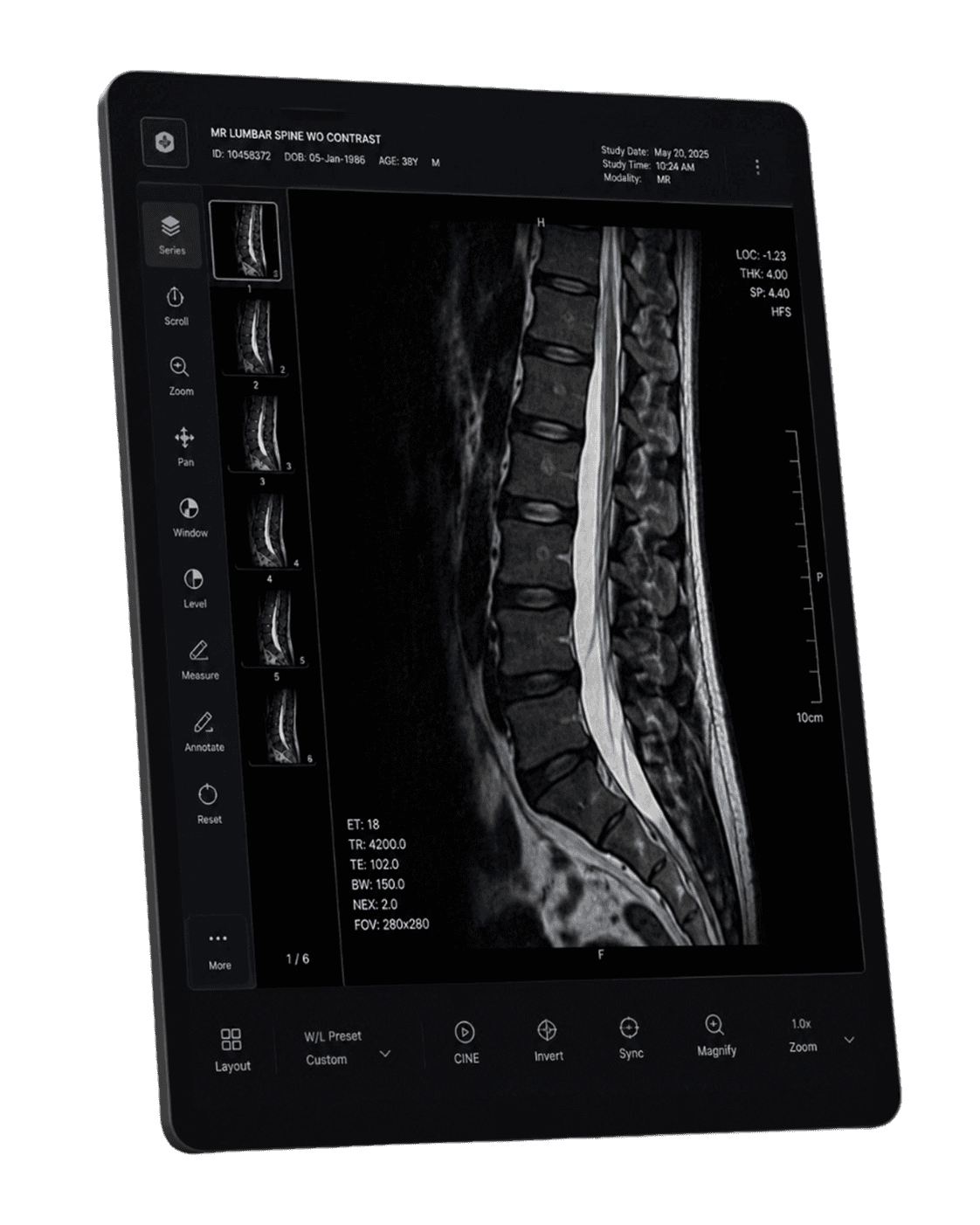 MRI DICOM viewer