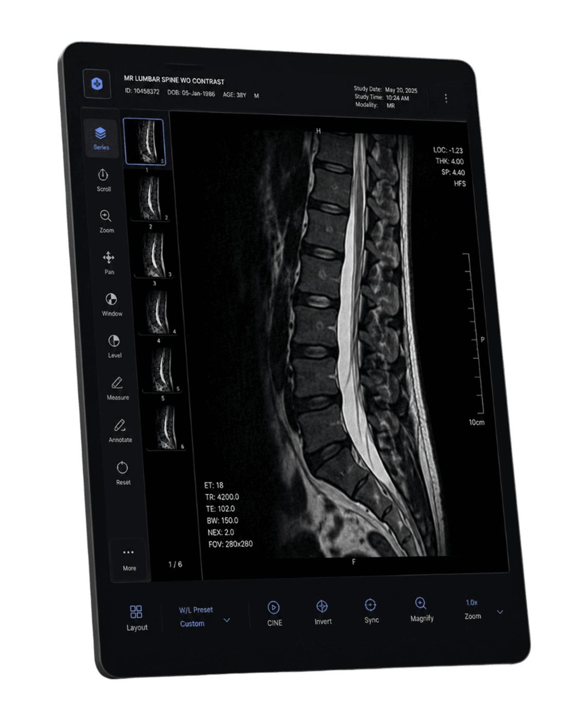 MRI DICOM viewer