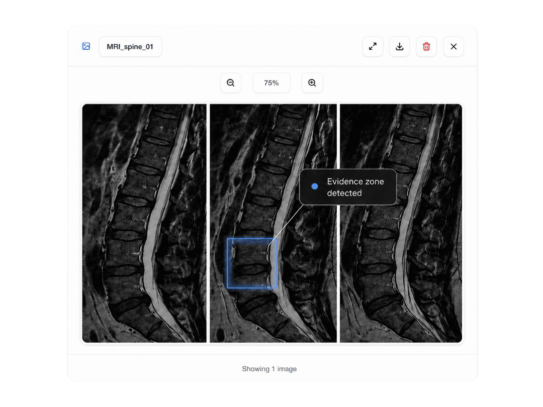 Avicen radiography viewer: highlighting evidence directly on a medical image with source-backed annotations