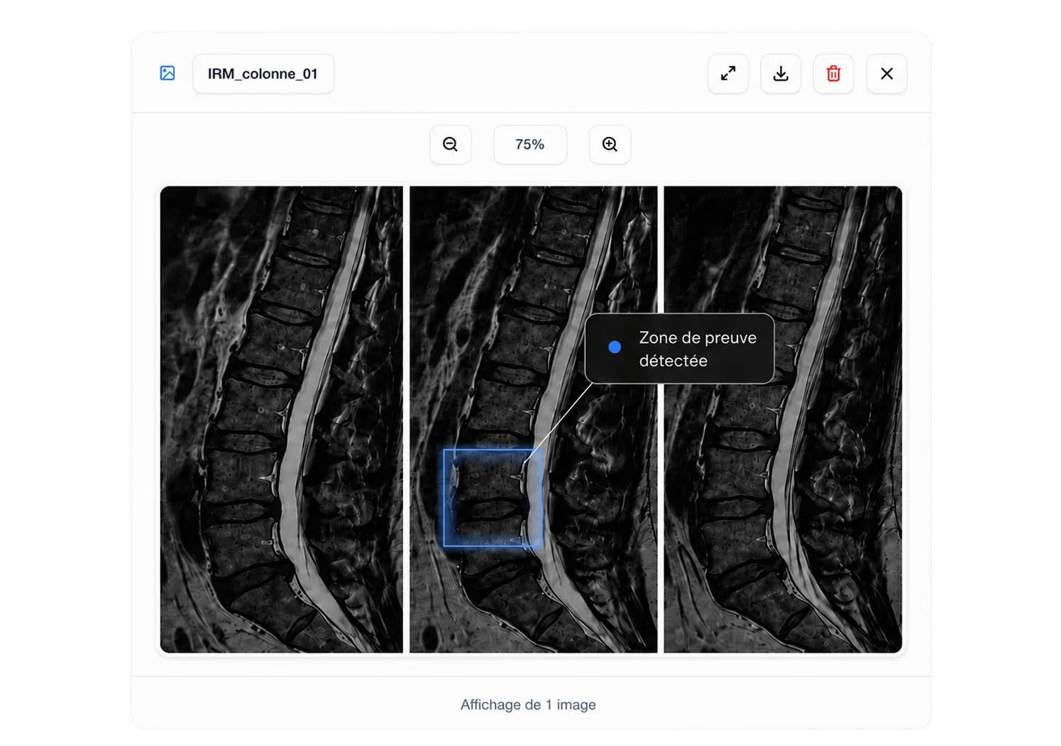 Visionneuse Avicen mettant en évidence les sources sur une image médicale